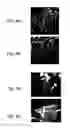 Fig. 04 - Methods of and compositions for inhibiting the proliferation of mammalian cells