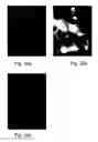 Fig. 22 - Methods of and compositions for inhibiting the proliferation of mammalian cells