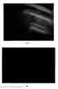 Fig. 03 - Molded articles having a granular or speckled appearance and process therefor