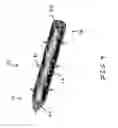 Fig. 05 - Brachytherapy method and applicator for treatment of metastatic lesions in a load bearing region