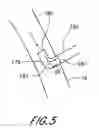Fig. 06 - Cannulae having a redirecting tip