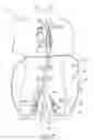 Fig. 08 - Cannulae having a redirecting tip