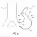 Fig. 09 - Cannulae having a redirecting tip