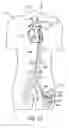 Fig. 11 - Cannulae having a redirecting tip