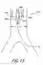 Fig. 16 - Cannulae having a redirecting tip