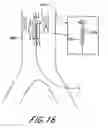 Fig. 17 - Cannulae having a redirecting tip