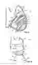 Fig. 06 - Implantable heart assist devices and methods