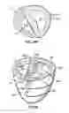 Fig. 12 - Implantable heart assist devices and methods