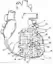 Fig. 01 - Heart support to prevent ventricular remodeling