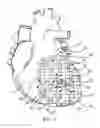 Fig. 02 - Heart support to prevent ventricular remodeling