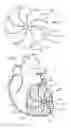 Fig. 06 - Heart support to prevent ventricular remodeling