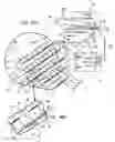 Fig. 14 - Heart support to prevent ventricular remodeling