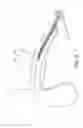 Fig. 03 - Penile prosthesis and method of implantation