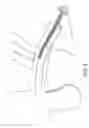 Fig. 09 - Penile prosthesis and method of implantation