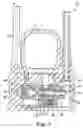 Fig. 06 - Implantable penile prosthesis pump