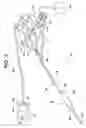 Fig. 04 - Endoscopic imaging and intervention system
