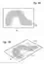 Fig. 05 - Method and apparatus for displaying endoscopic images