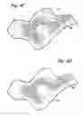 Fig. 06 - Method and apparatus for displaying endoscopic images