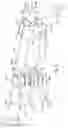 Fig. 06 - Articulated retractor blade holder
