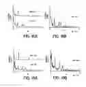 Fig. 17 - Hemoglobinometers and the like for measuring the metabolic condition of a subject