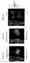 Fig. 06 - Method and system for automatic extraction of load-bearing regions of the cartilage and measurement of biomarkers