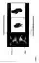 Fig. 07 - Method and system for automatic extraction of load-bearing regions of the cartilage and measurement of biomarkers