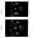 Fig. 09 - Method and system for automatic extraction of load-bearing regions of the cartilage and measurement of biomarkers