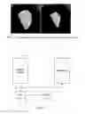 Fig. 07 - Cardiac display methods and apparatus