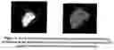 Fig. 06 - Cardiac display methods and apparatus