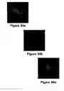 Fig. 46 - Combined PET/MRI scanner