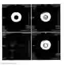 Fig. 01 - Ionic and non-ionic radiograhic contrast agents for use in combined X-ray and nuclear magnetic resonance diagnostics