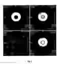 Fig. 02 - Ionic and non-ionic radiograhic contrast agents for use in combined X-ray and nuclear magnetic resonance diagnostics