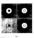 Fig. 03 - Ionic and non-ionic radiograhic contrast agents for use in combined X-ray and nuclear magnetic resonance diagnostics
