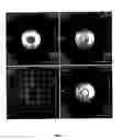 Fig. 04 - Ionic and non-ionic radiograhic contrast agents for use in combined X-ray and nuclear magnetic resonance diagnostics