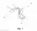 Fig. 02 - Device and method for preventing magnetic-resonance imaging induced damage
