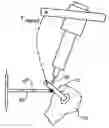 Fig. 01 - Apparatus and method for registering the position of a surgical robot