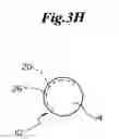 Fig. 11 - Rotational markers