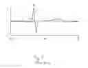 Fig. 02 - Method and apparatus for measuring heart related parameters