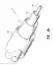 Fig. 04 - Programmable implantable pump with accessory reservoirs and multiple independent lumen catheter