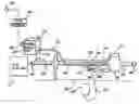 Fig. 01 - Method and apparatus for delivering an agent to the abdomen