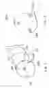 Fig. 04 - Method and apparatus for delivering an agent to the abdomen