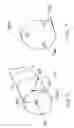 Fig. 04 - Method and apparatus for delivering an agent to the abdomen