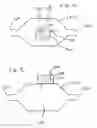 Fig. 09 - Method and apparatus for delivering an agent to the abdomen