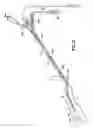 Fig. 04 - Methods and apparatus for treating the interior of a blood vessel