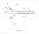 Fig. 05 - Method and apparatus for venous drainage and retrograde coronary perfusion