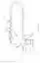 Fig. 07 - Method and apparatus for venous drainage and retrograde coronary perfusion