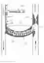Fig. 01 - Combination thrombolytic infusion catheter and dilator system