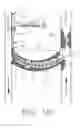 Fig. 07 - Combination thrombolytic infusion catheter and dilator system
