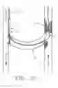 Fig. 08 - Combination thrombolytic infusion catheter and dilator system