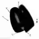 Fig. 07 - Shaping suture for treating congestive heart failure